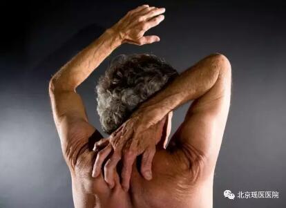 【警惕】身上经常“痒”或暗示恶性肿瘤(图1)