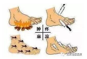 当足部出现这三个表现时，已经提醒你糖尿病可能要造访(图2)