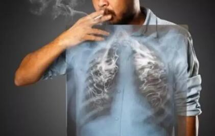 为什么年轻人患肿瘤率越来越高?这6个原因必须关注!(图2)