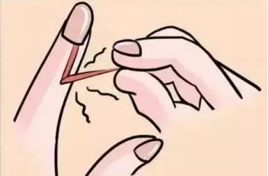 身体发生这些“小事”，可能是糖尿病在“敲门”(图2)