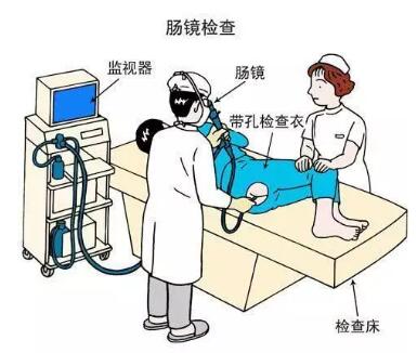 大便变细就是得了肠肿瘤?医生说：不一定，还有这些可能(图4)