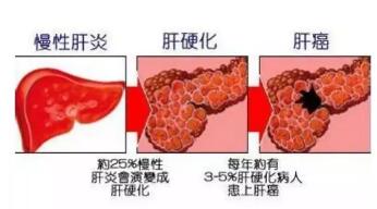 【别慌】肿瘤前病变不是瘤，积极治疗可逆转(图2)