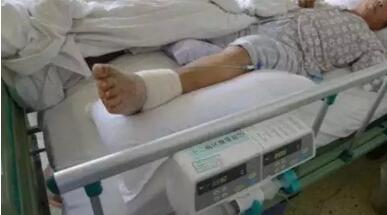 肿瘤晚期患者为何会出现下肢水肿?如何应对?(图3)