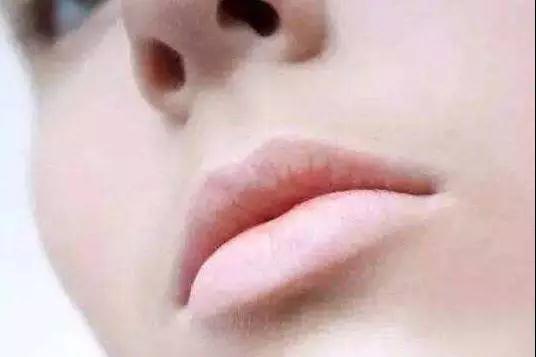 嘴唇是身体的晴雨表 观嘴唇知健康(图3)