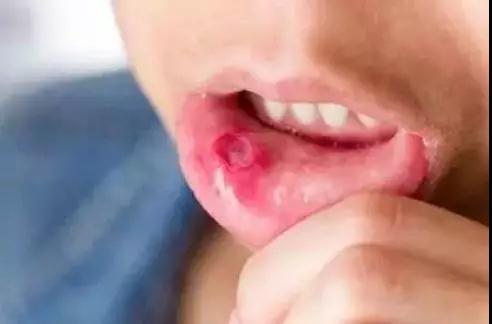 小病不治，大病难医!这六种常见小病最易恶变，可惜知道的(图2)