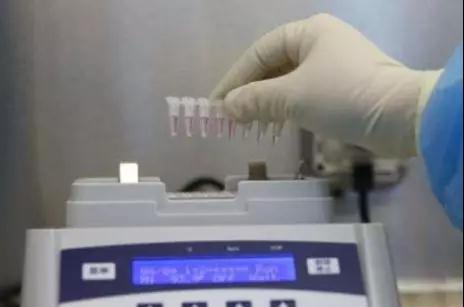 核酸阴性不能排除新冠感染？新冠肺炎的确诊方法有哪些？(图3)