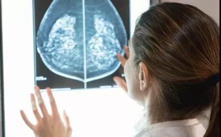 最新研究证明：心血管疾病会加速乳腺癌复发(图2)