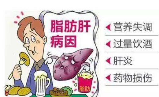 警惕!脂肪是导致肝癌的“罪魁祸首”!你的肝脏，还好吗?(图3)