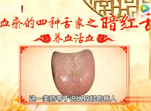 舌头颜色越深，血瘀越严重，如何改善血瘀体质?4大调理方法(图2)