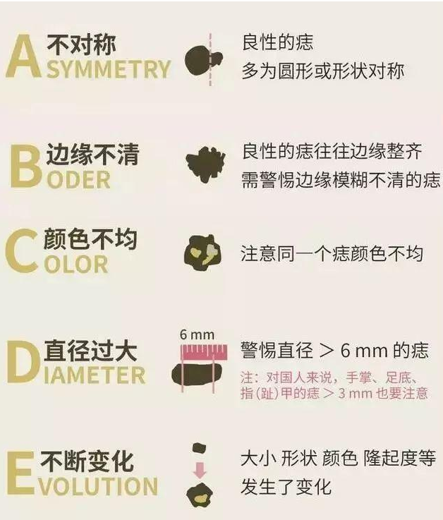 医生提醒：“痣”长这些地方都要切除！(图3)