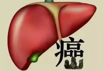 警惕：持续反复“打嗝”的病根儿可能是肝癌!(图3)