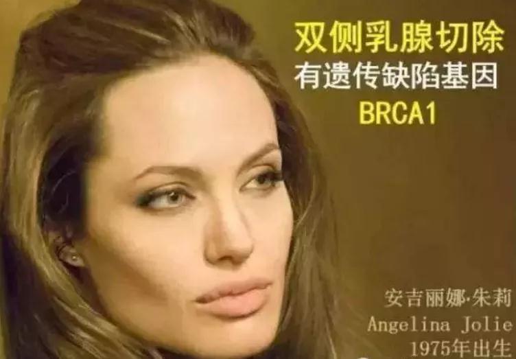 乳腺癌高危人群，一定要切除乳房吗?(图2)