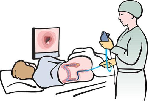 便血，是痔疮、结肠息肉、还是肠癌?”医生教你巧“辨’血(图3)