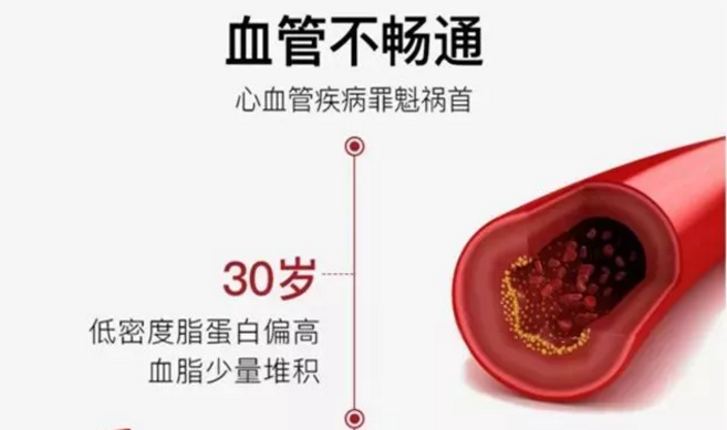 93岁院士说：这样做降脂溶栓护血管，可以少往可以少往医院(图3)