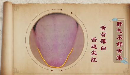 乳腺增生不要慌，这些小妙招让您轻松应对，抑制增生(图2)