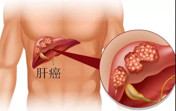 它是世界公认的“一级致癌物”，很多人却当做宝(图2)