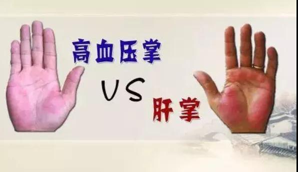 挺准!手掌上这块肉，一看就知道你身体好不好!(图6)