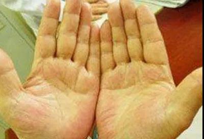 挺准!手掌上这块肉，一看就知道你身体好不好!(图5)