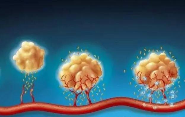 身体发现肿块就是癌吗?医生教你分辨“息肉”和“肉瘤”(图2)