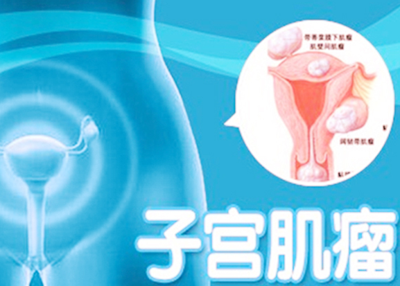 良性肿瘤也要警惕!良性的也会要命!(图2)