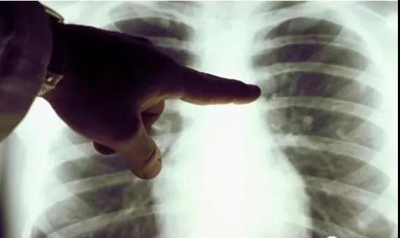 这些降压药都是高致癌，赶紧看看你吃的是哪一种！(图2)