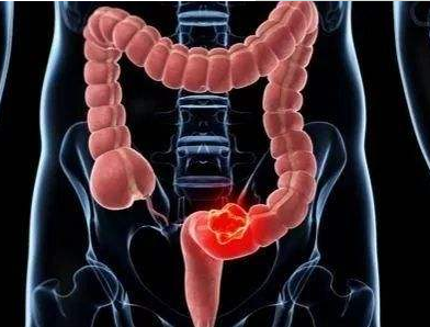 六种癌症会遗传!家里有病史的人，做好2件事，能避开....(图3)