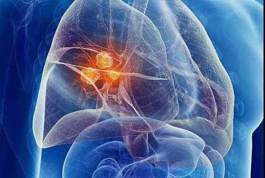 六种癌症会遗传!家里有病史的人，做好2件事，能避开....(图6)