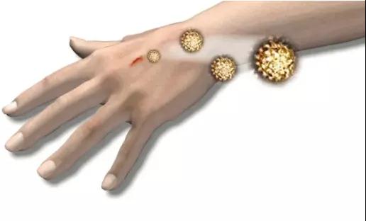 鱼刺扎了一下，5年没好变成癌!赵忠祥就因这种癌去世!(图4)