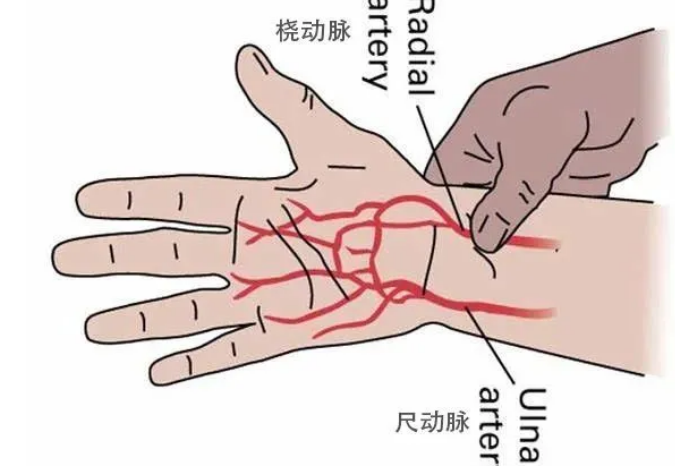 为什么说每个人的血管都可能会堵?(图6)