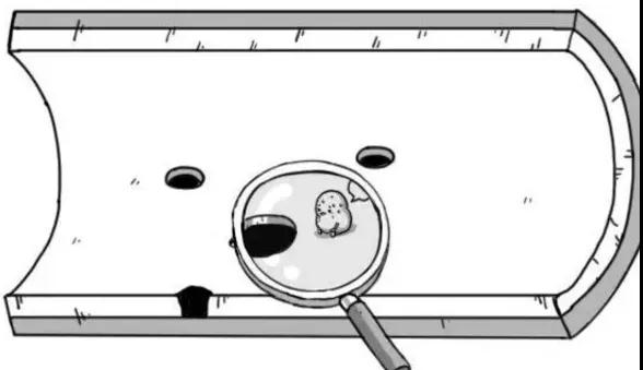 为什么说每个人的血管都可能会堵?(图3)