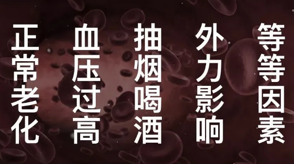 为什么说每个人的血管都可能会堵?(图4)