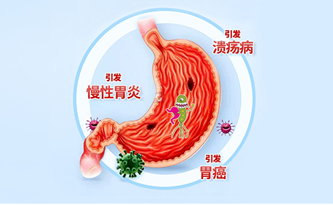 感染幽门螺杆菌，就会得胃癌吗?(图3)