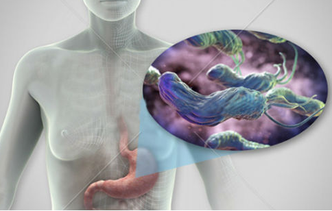 感染幽门螺杆菌，就会得胃癌吗?(图2)