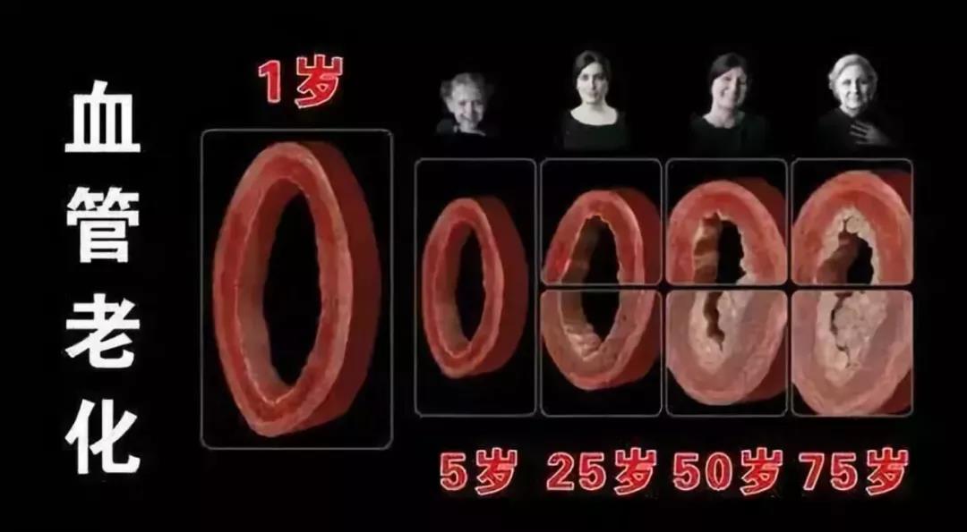 这根血管很怕堵，2个病变要点需注意，不妨​给血管..(图3)