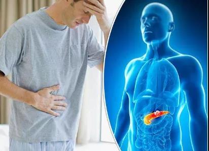 突发糖尿病，警惕胰腺癌(图2)