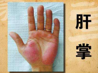 皮肤异常,或是癌症的征兆,这5个改变可能是癌症的信号(图5)