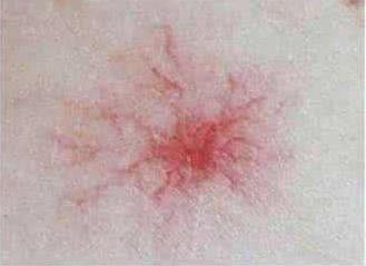 皮肤异常,或是癌症的征兆,这5个改变可能是癌症的信号(图4)