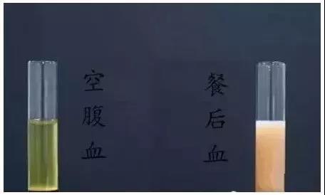 抽血检查的时候，为什么要空腹?看完你就懂了!(图2)