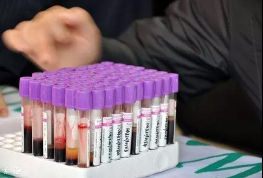 抽血检查的时候，为什么要空腹?看完你就懂了!(图4)