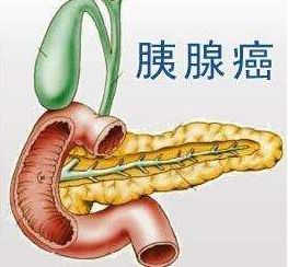 预防胰腺癌可多吃鱼 风险可降低30%(图2)