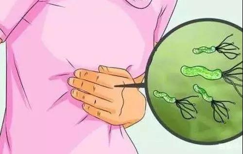 出现这2个信号，是胃溃疡癌变了！(图3)