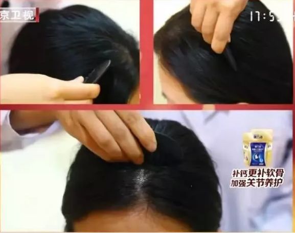 健康 | 家中这些小物件，用对了都是“养生神器”~(图7)