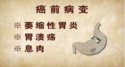 胃息肉：往前一步就是胃肿瘤!发现胃息肉，建议你这么做!(图2)