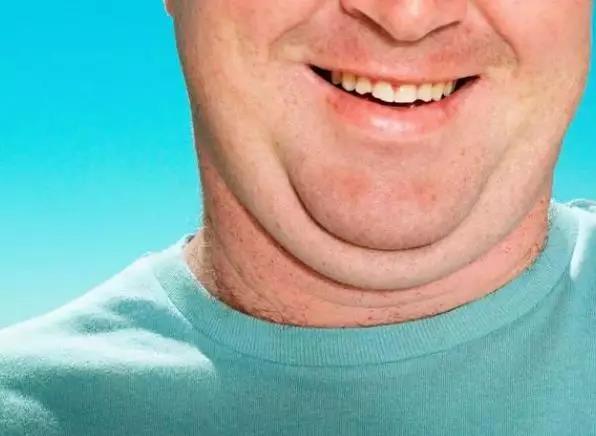 男人这超过39厘米,女人这超过35厘米,很危险!还有肿瘤...(图1)