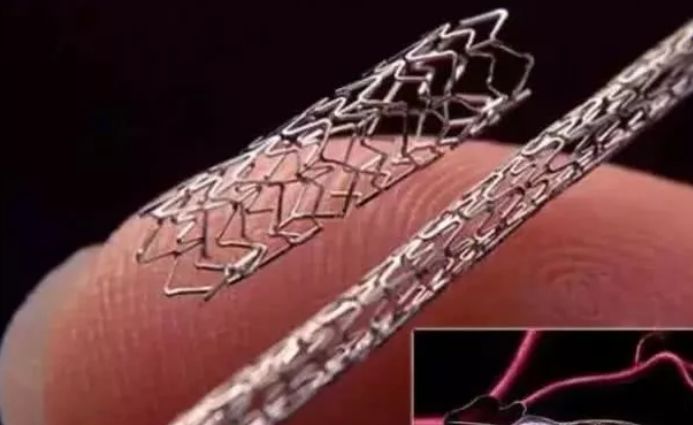 半年内5名心血管专家接连落马，背后是：乱装支架，装..(图3)