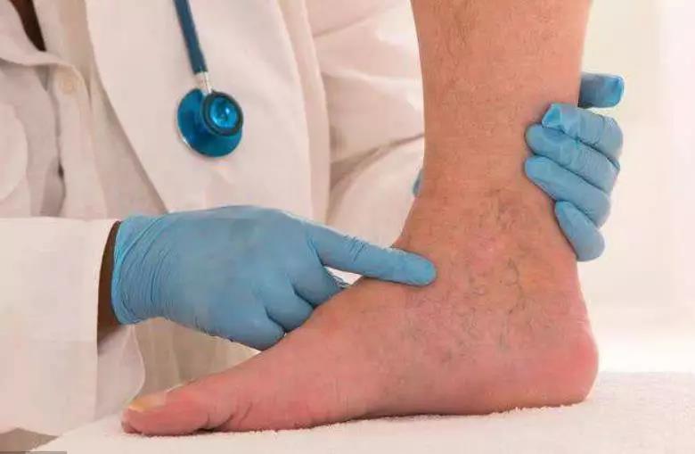 【关注】肿瘤晚期患者为何会出现下肢水肿?如何应对?(图1)