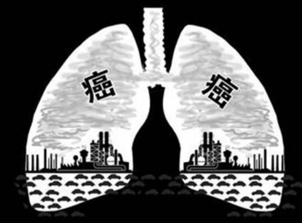 【关注】会呼吸的痛，哪些“痛”是肺肿瘤的报警器(图3)