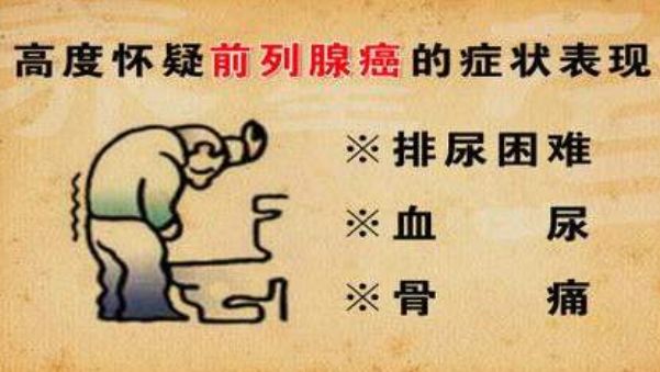 前列腺增生别忽视，治疗不当或变为前列腺肿瘤，几个...(图3)