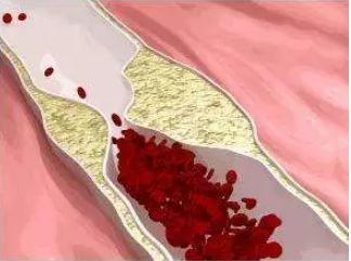 体内血稠，睡觉就能知?在睡眠中有这四个表现说明你的....(图2)