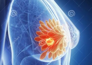 【揭秘】不抽烟、不喝酒、没遗传，为什么得恶性肿瘤的....(图2)